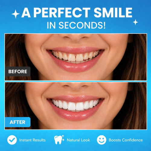 Ocularis Insta Veneers