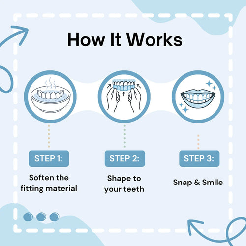 Ocularis Insta Veneers
