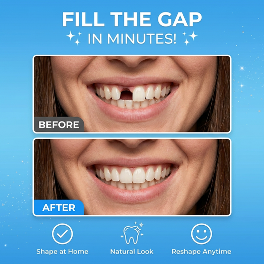 Ocularis Insta Tooth, Moldable Gap Filler Beads